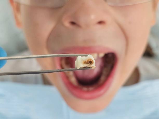 Best After-Hours Emergency Dentist in Herington, KS