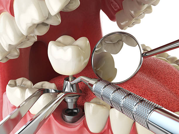 Best Walk-In Emergency Dentist in Herington, KS